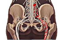 Люмбоишиалгия