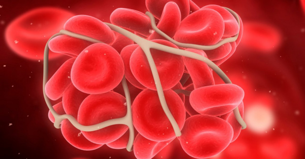 ДВС-синдром ДВС-синдром