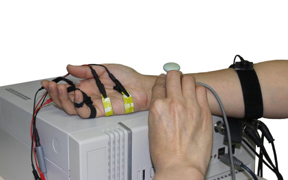 Снятие электронейромиографии руки