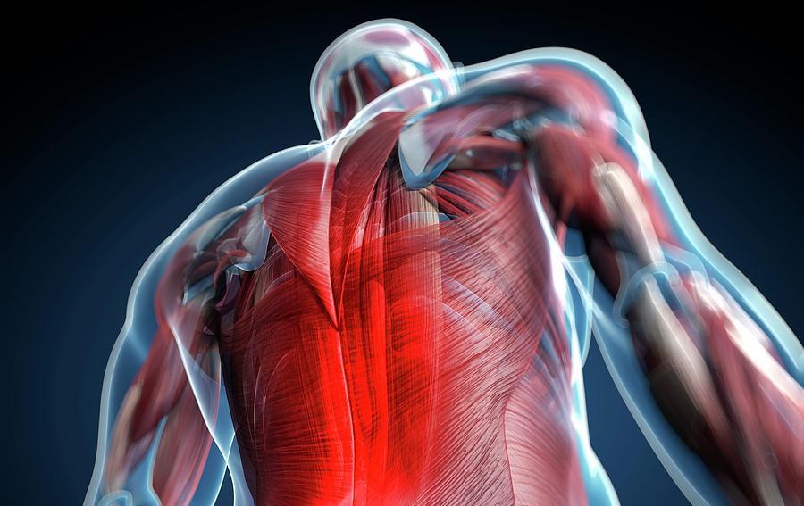 Болезненность мышц спины при миофасциальном синдроме