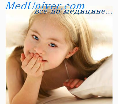 синдром дауна в неврологии