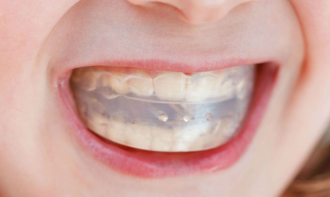 Феномен попова годона мкб 10