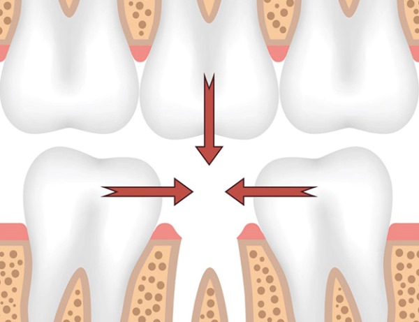 Эффект попова годона