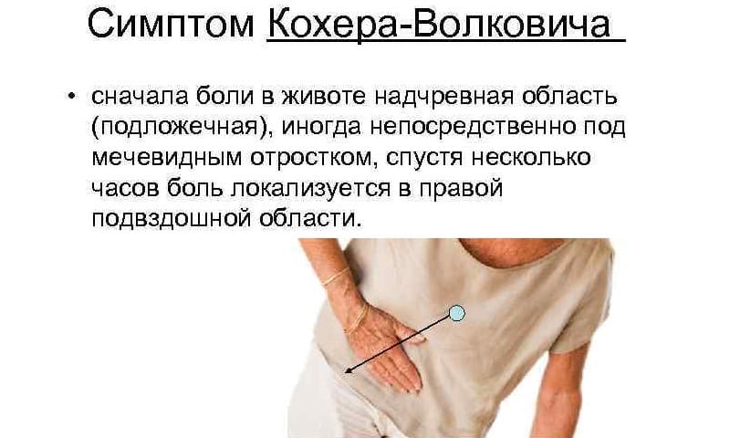 Как проявляются симптомы Щеткина — Блюмберга и Кохера — Волковича при аппендиците