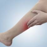 Хроническая венозная недостаточность код по МКБ 10: что это такое?