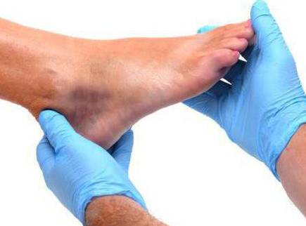 Код мкб растяжение связок правого голеностопного сустава