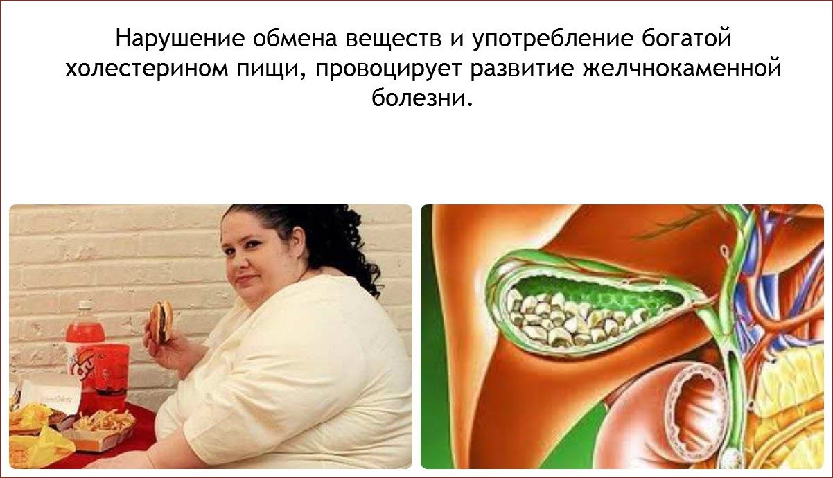 Нарушение обмена веществ