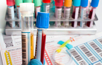 общий анализ крови и мочи