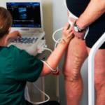 Мигрирующий тромбофлебит: симптомы и лечение