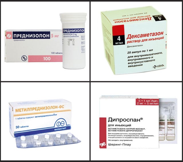 Остеохондроз шейного отдела синдром плечо кисть