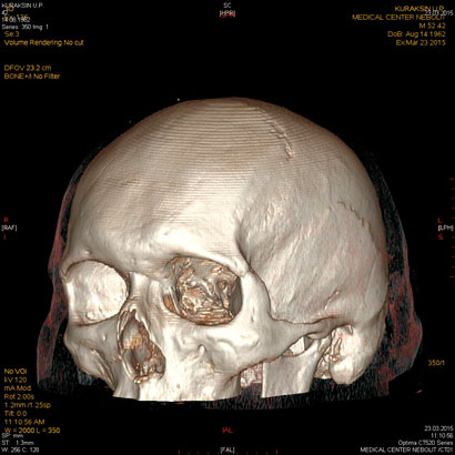 clip_image002.jpg clip_image002.jpg