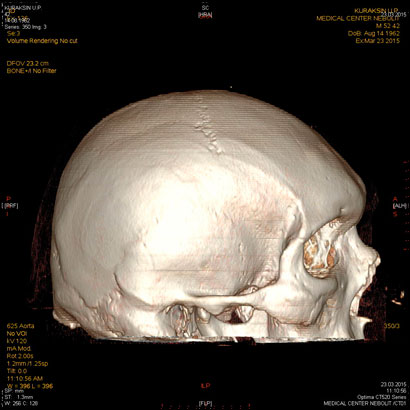 clip_image003.jpg clip_image003.jpg