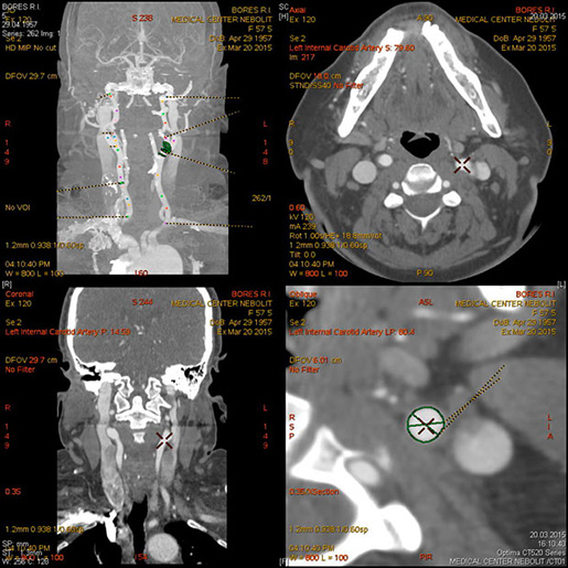 clip_image004.jpg clip_image004.jpg