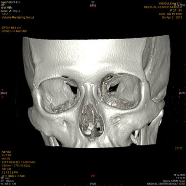 clip_image009.jpg clip_image009.jpg