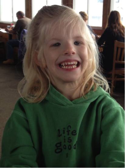 синдром кошачьего крика