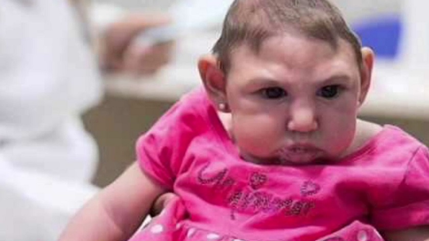 характерные черты лишней хромосомы