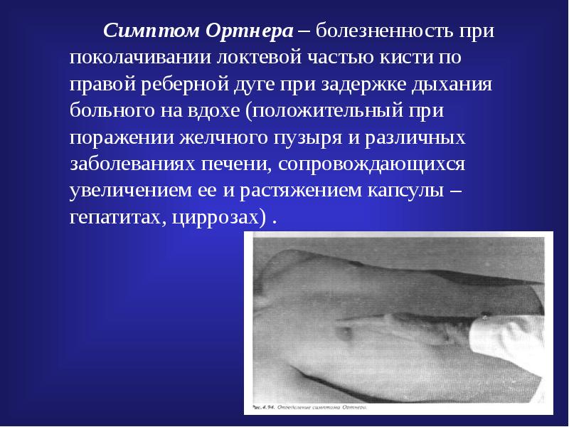 Синдром ортнера при холецистите это