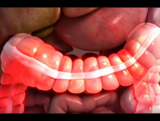 Главный симптом СРК - нарушение акта дефекации.