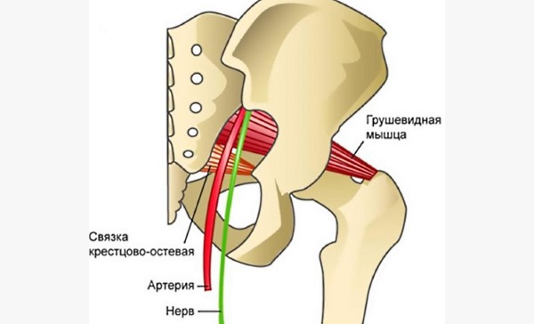 При спазме грушевидной мышцы происходит зажатие нервов и сосудов