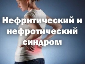 Боль в пояснице