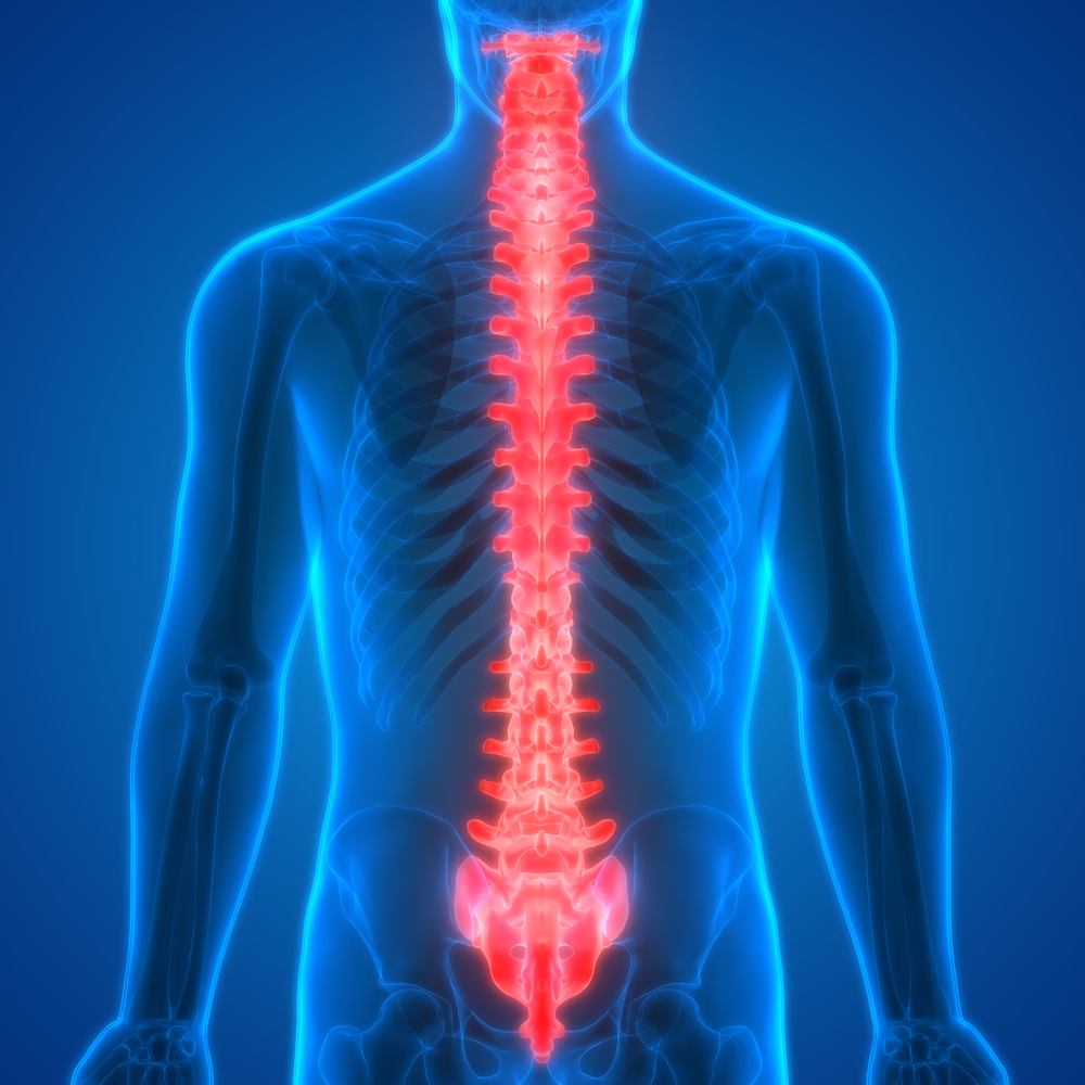 Нередко прогрессирование болезни приводит к поражению спинного мозга, что влечет за собой тяжелые последствия, вплоть до полного паралича