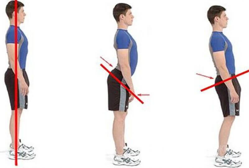 Плоская спина