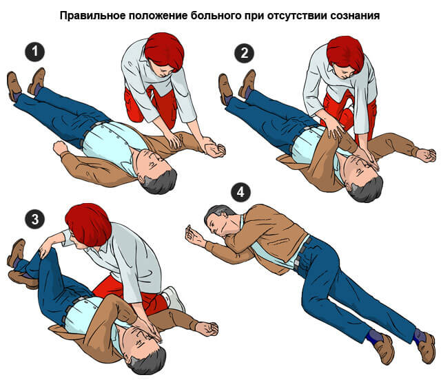 положение тела при потере сознания
