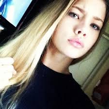 Признаки синдрома дауна