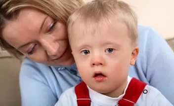 Ребёнок с синдромом Дауна