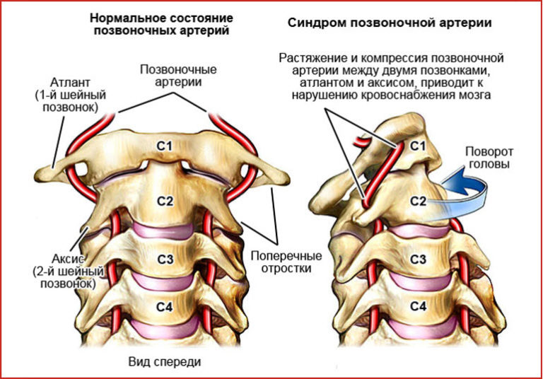позвоночный столб