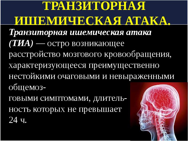 ишемическая атака