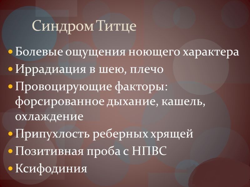 Синдром Титце